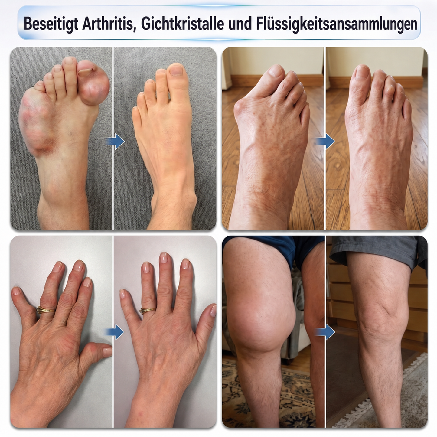 𝗢𝗙𝗙𝗜𝗭𝗜𝗘𝗟𝗟𝗘𝗥 𝗦𝗛𝗢𝗣 | 𝗜𝗙𝑴𝑨𝑮𝑰𝑪® 0,05 mm 𝗠𝗶𝗸𝗿𝗼𝘀𝗽𝗶𝘁𝘇𝗲𝗻-𝗥𝗼𝗹𝗹𝗮𝗽𝗽𝗹𝗶𝗸𝗮𝘁𝗼𝗿 𝗳ü𝗿 𝗚𝗲𝗹𝗲𝗻𝗸- & 𝗞𝗻𝗼𝗰𝗵𝗲𝗻𝗽𝗳𝗹𝗲𝗴𝗲 🦴